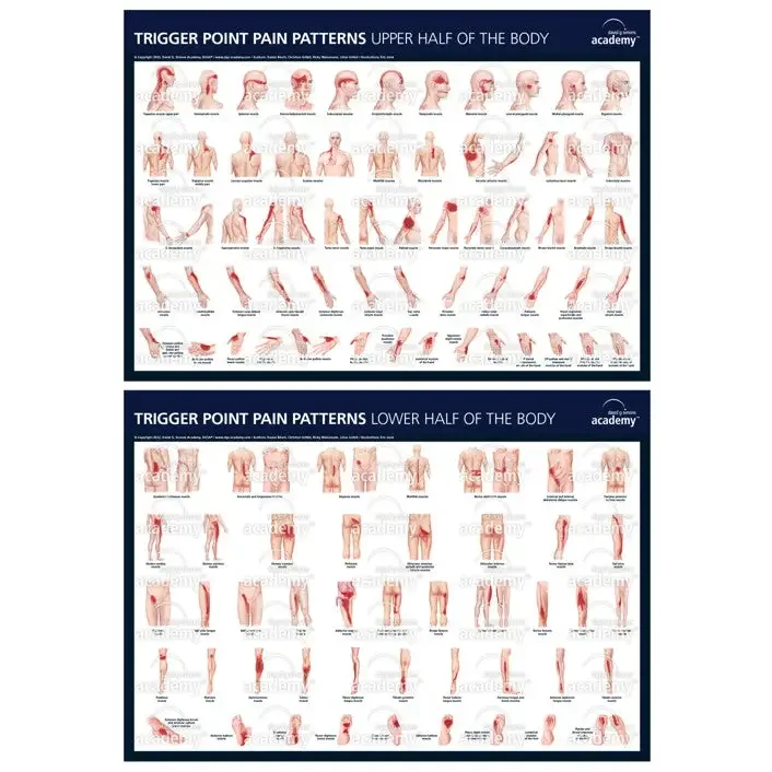Lot de 2 posters des points trigger de la DGSA - Aiguilles de dry-needling