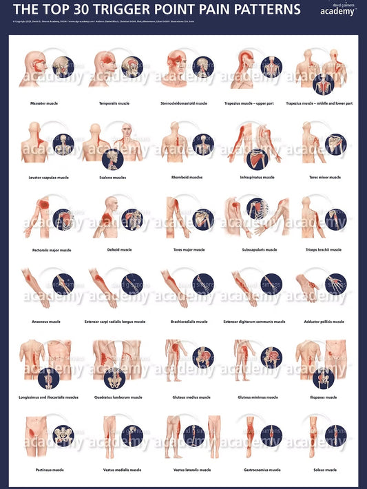 Poster TOP30 des points trigger de la DGSA