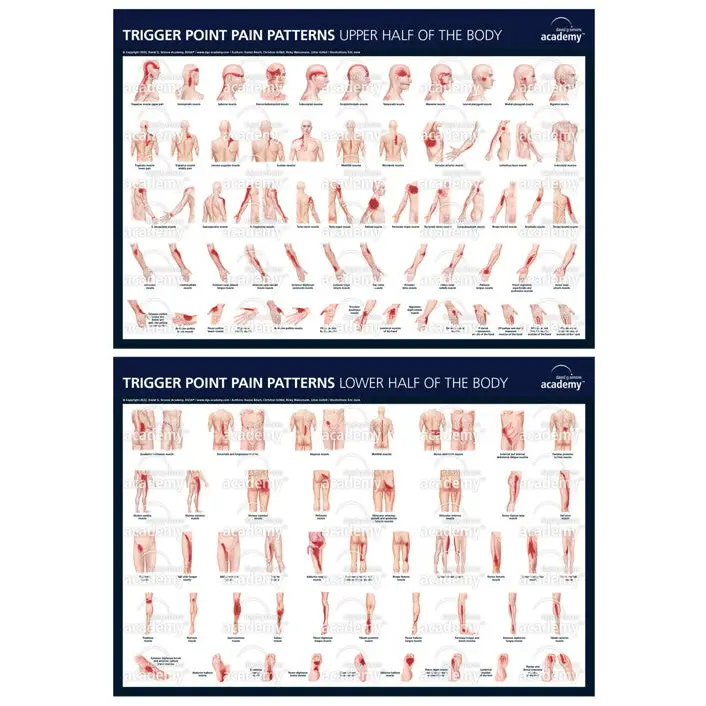 Lot de 2 posters des points trigger de la DGSA - Aiguilles de dry-needling