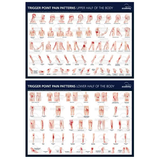 Lot de 2 posters des points trigger de la DGSA - Aiguilles de dry-needling
