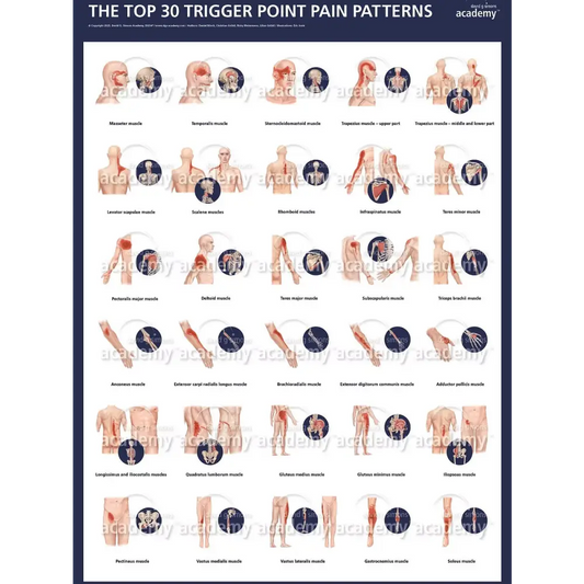 Poster TOP30 des points trigger de la DGSA - Aiguilles de dry-needling
